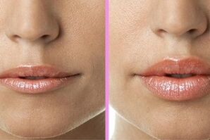 antes e despois da restauración dos beizos